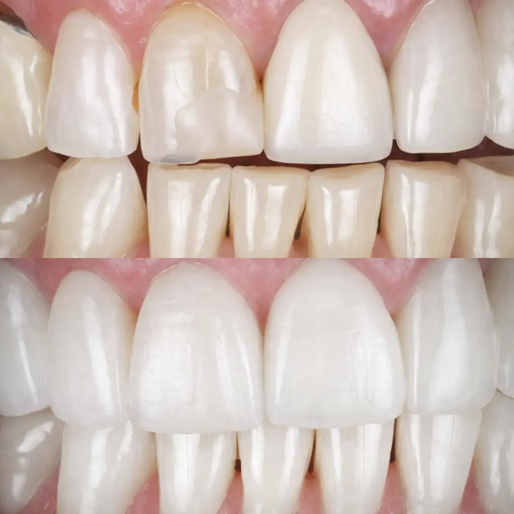 Cotton Tree Dental Before After Case 12
