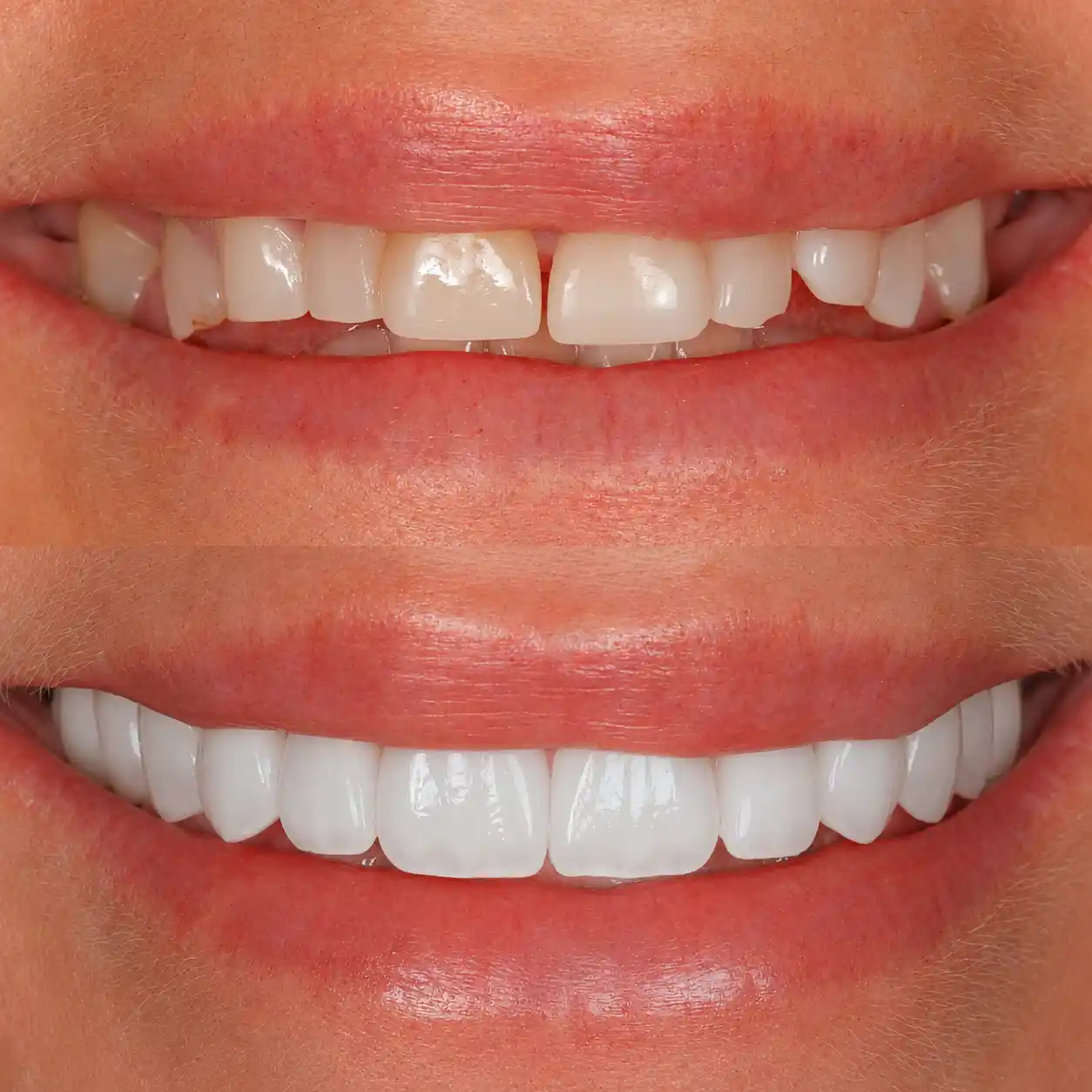 Cotton Tree Dental Before After Case 2