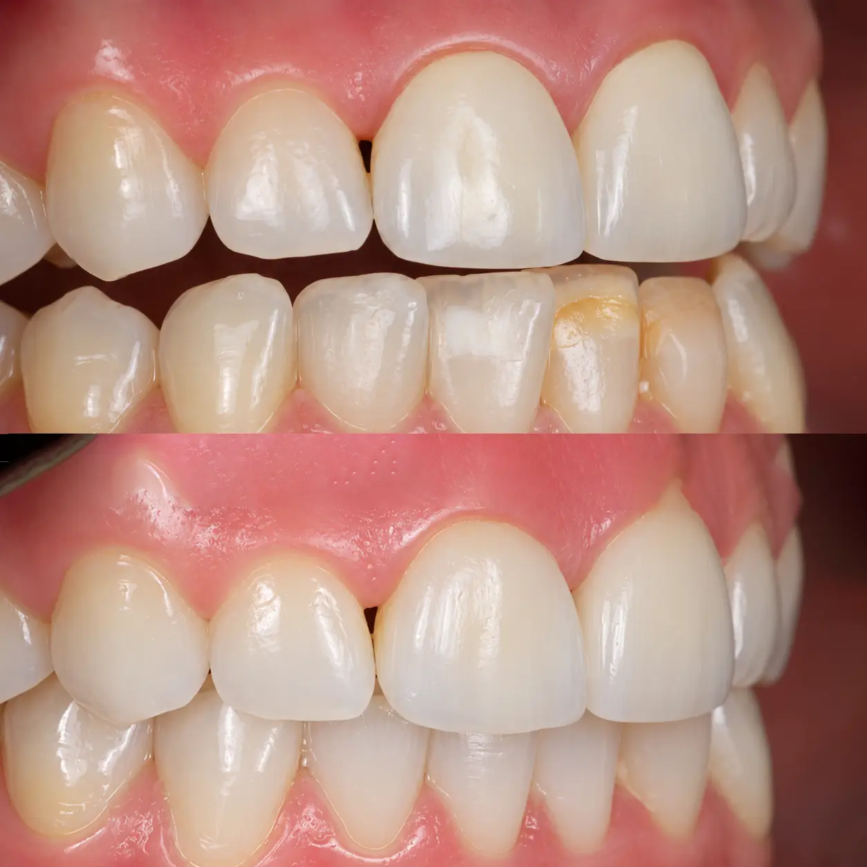 Cotton Tree Dental Before After Case 7