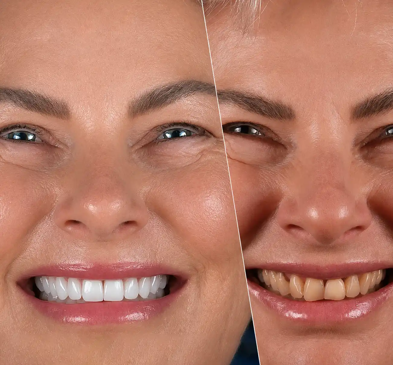 Close-up split image of a woman smiling, showing contrasting emotions. Left side is joyful and bright, right side shows a tense, intense expression.