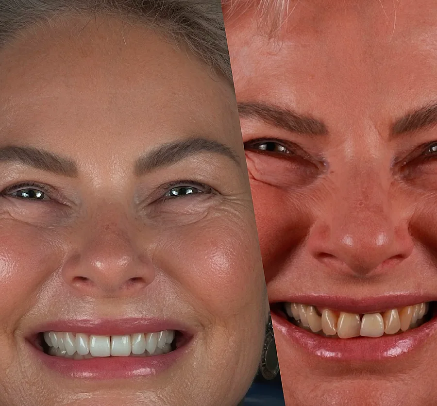 Close-up split image of a woman smiling, showing contrasting emotions. Left side is joyful and bright, right side shows a tense, intense expression.
